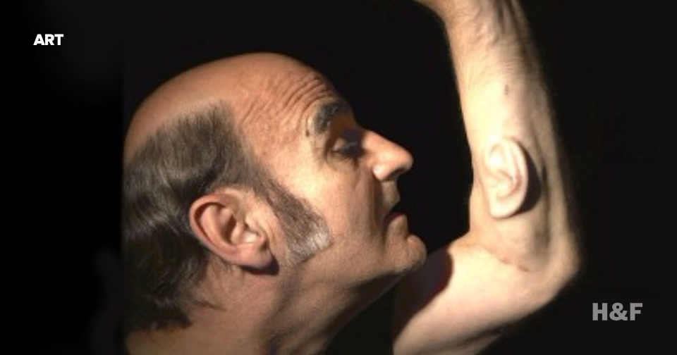 Australian artist grows third ear on arm