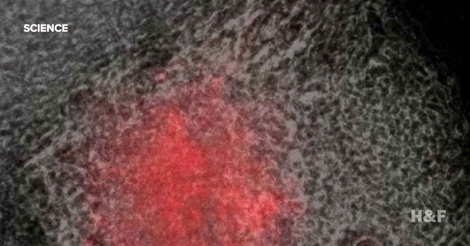 Scientists grow miniature beating hearts from stem cells