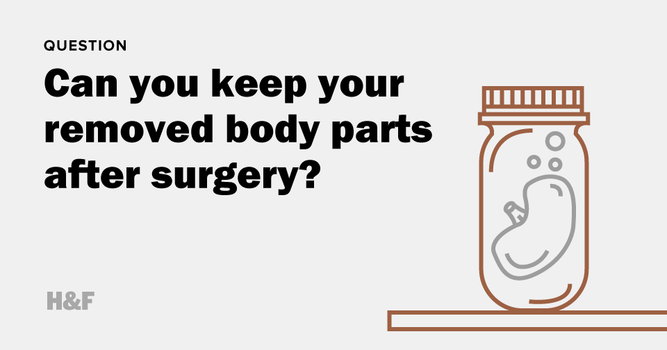 Can you keep your removed body parts after surgery?