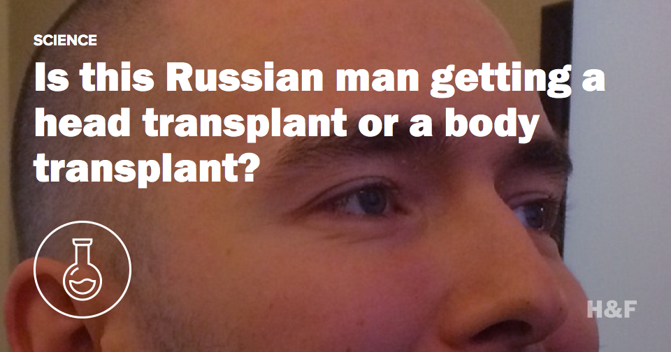 Is this Russian man getting a head transplant or a body transplant?