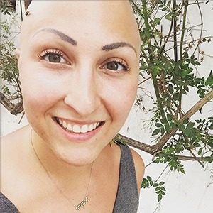 Жизнь с алопецией:
Я потеряла волосы,
но обрела веру в себя — Личный опыт на Wonderzine